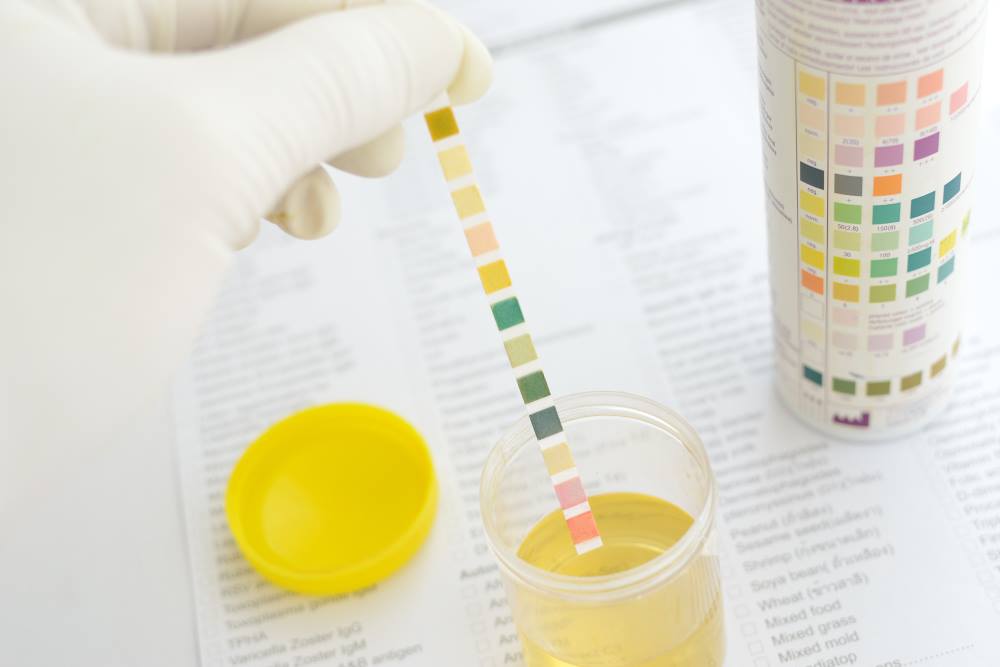 Crystals in Urine: How are they Caused?